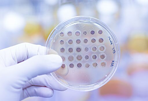 Gloved hand holding a culture plate with bacterial colonies